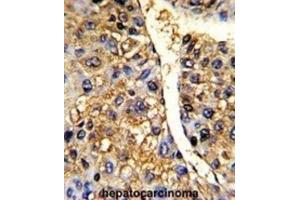 Immunohistochemistry (IHC) image for anti-Tu Translation Elongation Factor, Mitochondrial (Tufm) antibody (ABIN3001714) (TUFM 抗体)