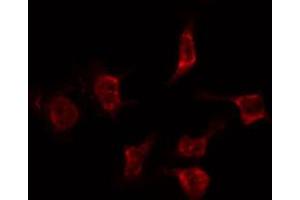 ABIN6268904 staining Hela by IF/ICC. (Cyclin F 抗体  (C-Term))