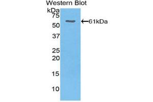 Western blot analysis of the recombinant protein. (THBS4 抗体  (AA 644-925))