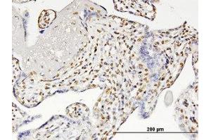 Image no. 1 for anti-Runt-Related Transcription Factor 2 (RUNX2) (AA 251-351) antibody (ABIN599359) (RUNX2 抗体  (AA 251-351))