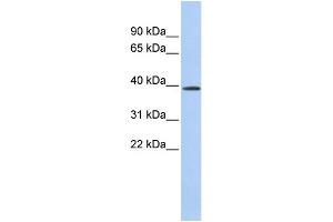 WB Suggested Anti-CLN6 Antibody Titration:  0. (CLN6 抗体  (Middle Region))