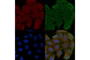 ABIN6259458 and ABIN6275227 staining Hela cells(30 min of UV treatment) by IF/ICC. (MBTPS1 抗体  (Internal Region))