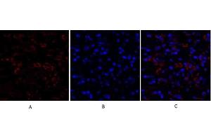 Immunofluorescence analysis of human breast cancer tissue. (Ki-67 抗体  (AA 3170-3250))