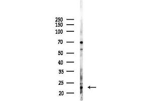 anti-Neuron-Specific Protein Family Member 1 (D4S234E) (Internal Region) antibody