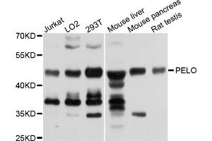 Western blot analysis of extracts of various cell lines, using PELO antibody (ABIN5972746) at 1/1000 dilution. (PELO 抗体)