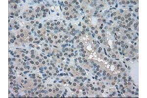 Image no. 1 for anti-Lactate Dehydrogenase A (LDHA) antibody (ABIN1499114) (Lactate Dehydrogenase A 抗体)