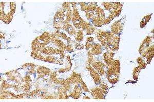 Immunohistochemistry of paraffin-embedded Rat heart using TRAP1 Polyclonal Antibody at dilution of 1:100 (40x lens). (TRAP1 抗体)