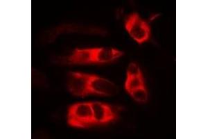 Immunofluorescent analysis of HFE staining in MCF7 cells. (HFE 抗体)