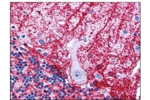 Human Brain, Cerebellum: Formalin-Fixed, Paraffin-Embedded (FFPE) (SIPA1L3 抗体  (N-Term))