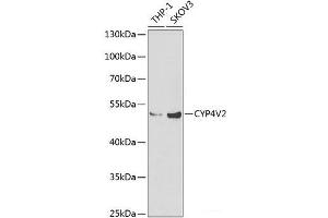 Western Blotting (WB) image for anti-Cytochrome P450, Family 4, Subfamily V, Polypeptide 2 (CYP4V2) antibody (ABIN7011220)