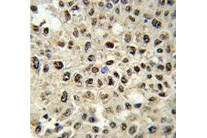Immunohistochemistry (IHC) image for anti-Sjogren Syndrome Antigen B (SSB) (AA 66-96) antibody (ABIN3032748)