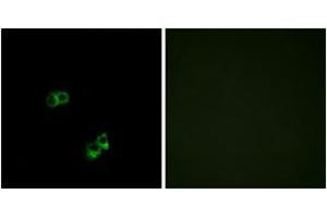 Immunofluorescence analysis of MCF7 cells, using MC5R Antibody. (MC5 Receptor 抗体  (AA 271-320))