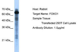 WB Suggested Anti-FOXO1 Antibody   Titration: 1. (FOXO1 抗体  (C-Term))