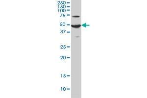ADCYAP1R1 monoclonal antibody (M01), clone 2B12 Western Blot analysis of ADCYAP1R1 expression in HeLa .