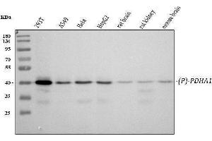 Western blot analysis of PDHA1 using anti-PDHA1 antibody (ABIN7603301).