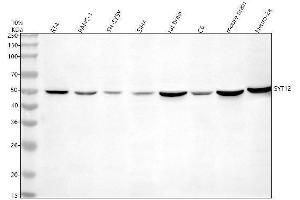 Western blot analysis of Synaptotagmin-12/SYT12 using anti-Synaptotagmin-12/SYT12 antibody (ABIN7825903).
