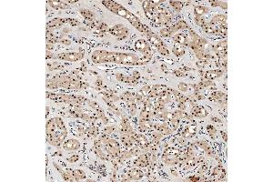 IHC analysis of SNRNP40 using anti-SNRNP40 antibody (ABIN7601719). (SNRNP40 抗体  (AA 43-357))