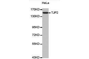 Western Blotting (WB) image for anti-Tight Junction Protein 2 (Zona Occludens 2) (TJP2) antibody (ABIN1875103) (TJP2 抗体)