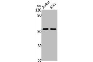 Western Blot analysis of Jurkat K562 cells using BAGE5 Polyclonal Antibody (BAG5 抗体  (N-Term))