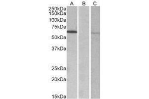 Western Blotting (WB) image for anti-Makorin Ring Finger Protein 1 (MKRN1) (AA 105-118) antibody (ABIN2464921) (MKRN1 抗体  (AA 105-118))