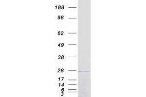 Validation with Western Blot