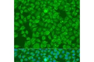 Immunofluorescence analysis of U2OS cells using SLC25A6 Polyclonal Antibody at dilution of 1:100. (SLC25A6 抗体)