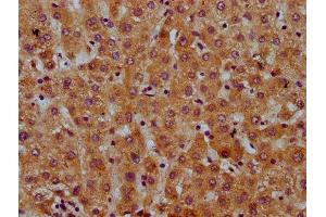 IHC image of ABIN7169368 diluted at 1:600 and staining in paraffin-embedded human liver tissue performed on a Leica BondTM system. (SAA2 抗体  (AA 19-94))