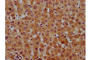 IHC image of ABIN7169368 diluted at 1:600 and staining in paraffin-embedded human liver tissue performed on a Leica BondTM system. (SAA2 抗体  (AA 19-94))