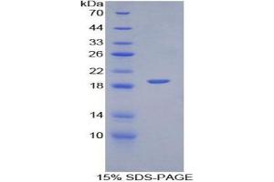 SDS-PAGE of Protein Standard from the Kit (Highly purified E.