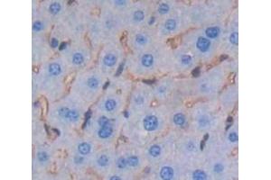 IHC-P analysis of Mouse Tissue, with DAB staining. (Lymphocyte Function Associated Antigen 2 (AA 23-203) 抗体)