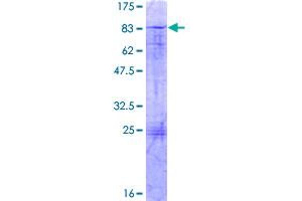 ZBTB14/ZFP161 Protein (AA 1-449) (GST tag)