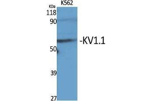 Western Blot (WB) analysis of specific cells using KV1. (KCNA1 抗体  (Internal Region))