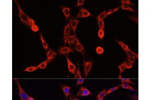 Immunofluorescence analysis of NIH/3T3 cells using ABCD1 Polyclonal Antibody at dilution of 1:100. (ABCD1 抗体)