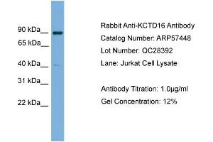 WB Suggested Anti-KCTD16  Antibody Titration: 0. (KCTD16 抗体  (N-Term))