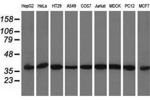Western blot analysis of extracts (35 µg) from 9 different cell lines by using anti-ACAT2 monoclonal antibody. (ACAT2 抗体)