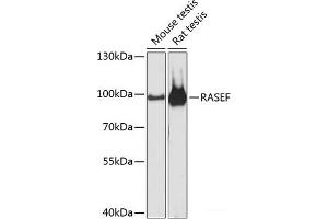 Western blot analysis of extracts of various cell lines using RASEF Polyclonal Antibody at dilution of 1:3000. (RASEF 抗体)