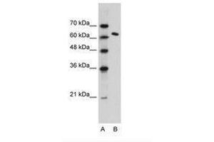Image no. 1 for anti-FACT complex subunit SPT16 (SUPT16H) (AA 77-126) antibody (ABIN203368) (SUPT16H 抗体  (AA 77-126))