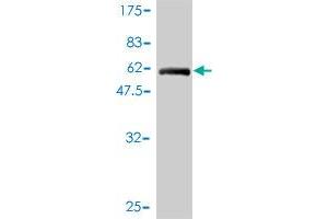 Western Blot detection against Immunogen (60. (TEX264 抗体  (AA 1-313))