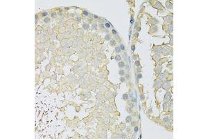 Immunohistochemistry of paraffin-embedded rat testis using SLC2A9 antibody (ABIN6291466) at dilution of 1:100 (40x lens). (SLC2A9 抗体)