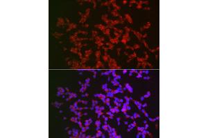 Immunofluorescence (IF) image for anti-Calcium/calmodulin-Dependent Protein Kinase IV (CAMK4) (AA 304-473) antibody (ABIN6137891)