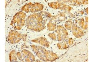Immunohistochemistry of paraffin-embedded human pancreatic tissue using ABIN7159422 at dilution of 1:100 (MESP1 抗体  (AA 149-268))