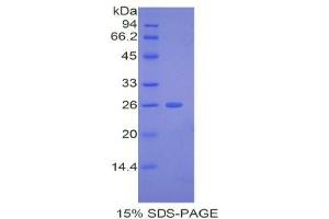 SDS-PAGE analysis of Mouse ADAMTS12 Protein. (ADAMTS12 蛋白)
