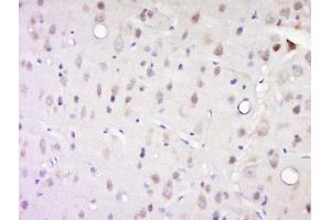 Paraformaldehyde-fixed, paraffin embedded rat brain, Antigen retrieval by boiling in sodium citrate buffer (pH6) for 15min, Block endogenous peroxidase by 3% hydrogen peroxide for 30 minutes, Blocking buffer (normal goat serum) at 37°C for 20min, Antibody incubation with Casein Kinase 1 alpha (Tyr294) Antibody, Unconjugated  at 1:200 overnight at 4°C, followed by a conjugated secondary and DAB staining. (CSNK1A1 抗体  (pTyr294))