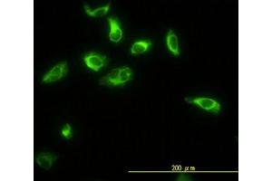 Image no. 4 for anti-Thiopurine S-Methyltransferase (TPMT) (AA 1-246) antibody (ABIN598985) (TPMT 抗体  (AA 1-246))