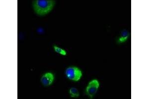 Immunofluorescence staining of MCF-7 cells with ABIN7175718 at 1:166, counter-stained with DAPI. (WDPCP 抗体  (AA 621-737))
