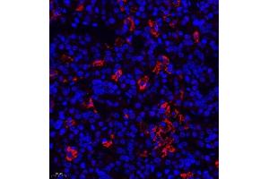 Immunofluorescence of paraffin embedded rat hypophysis using TSH (ABIN7075906) at dilution of 1:400 (400x lens) (TSHB 抗体)