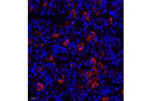 Immunofluorescence of paraffin embedded rat hypophysis using TSH (ABIN7075906) at dilution of 1:400 (400x lens) (TSHB 抗体)
