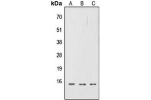 Western blot analysis of CD252 expression in A549 (A), NS-1 (B), H9C2 (C) whole cell lysates. (TNFSF4 抗体  (Center))