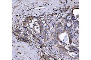 IHC analysis of FXR1 using anti-FXR1 antibody (ABIN7600093). (FXR1 抗体  (AA 149-614))