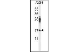 Western blot analysis in A2058 cell line lysates (35 ug/lane) using RPS11 Antibody (Center) Cat. (RPS11 抗体  (Middle Region))